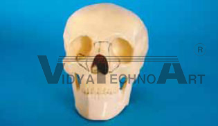 Skull, with holder, fractured, mandible